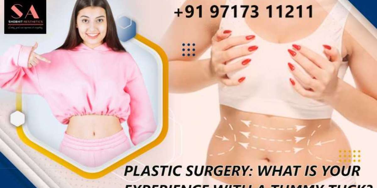 Plastic Surgery: What is your experience with a tummy tuck?
