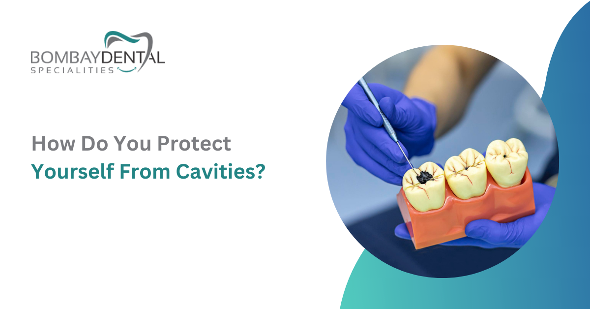 4 Simple Ways to Protect Your Smile from Cavities