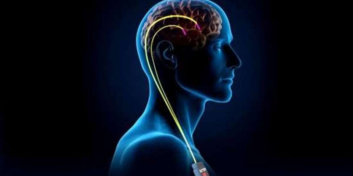 Deep Brain Stimulation Industry: Market Size, Share, and Future Projections