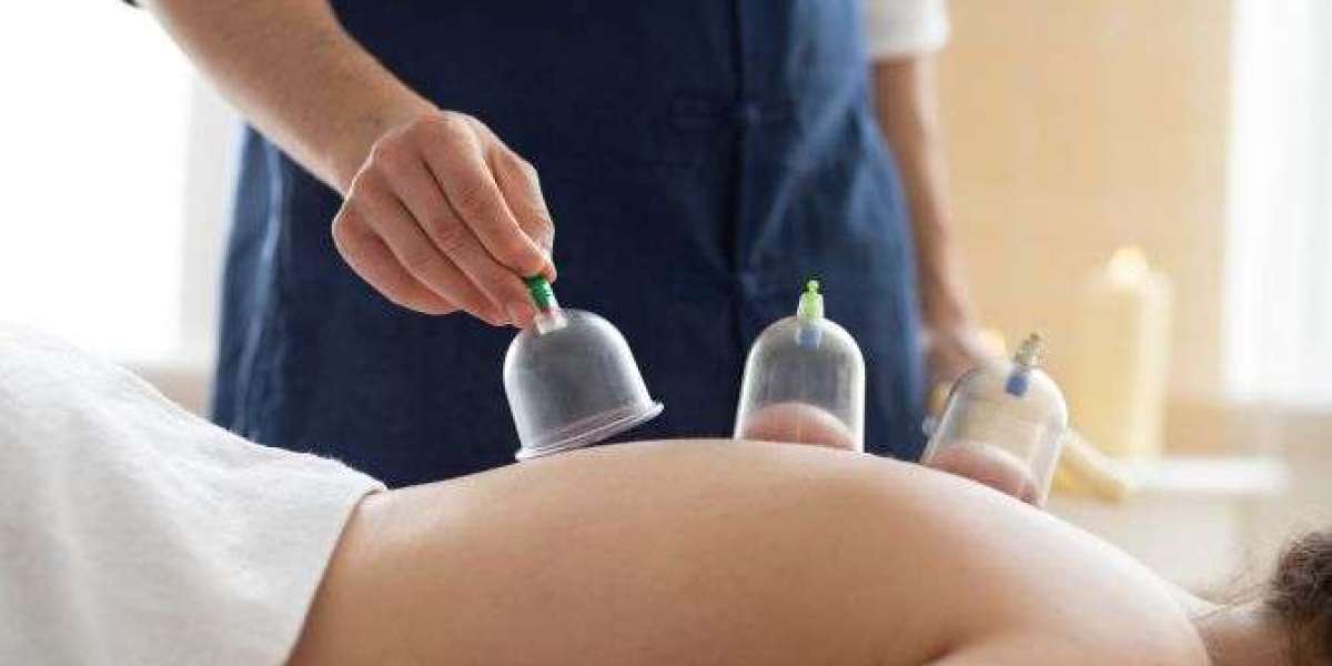Silicone Cupping Set for Lymphatic Drainage: Step-by-Step Guide