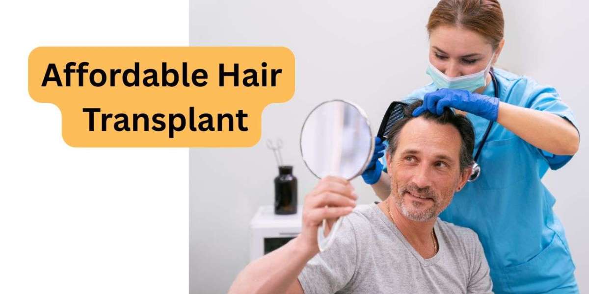 Affordable Hair Transplant: Essential Tips to Save Money and Get Results