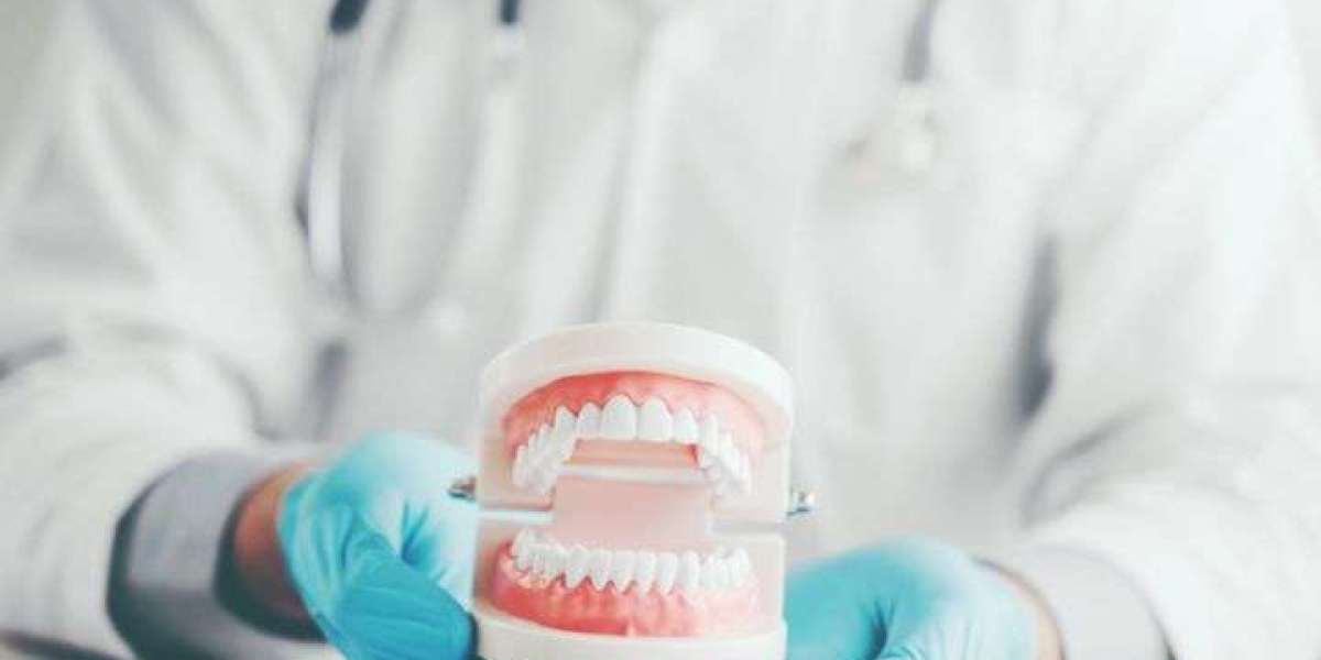 How Much Do Dental Veneers Cost in Australia?