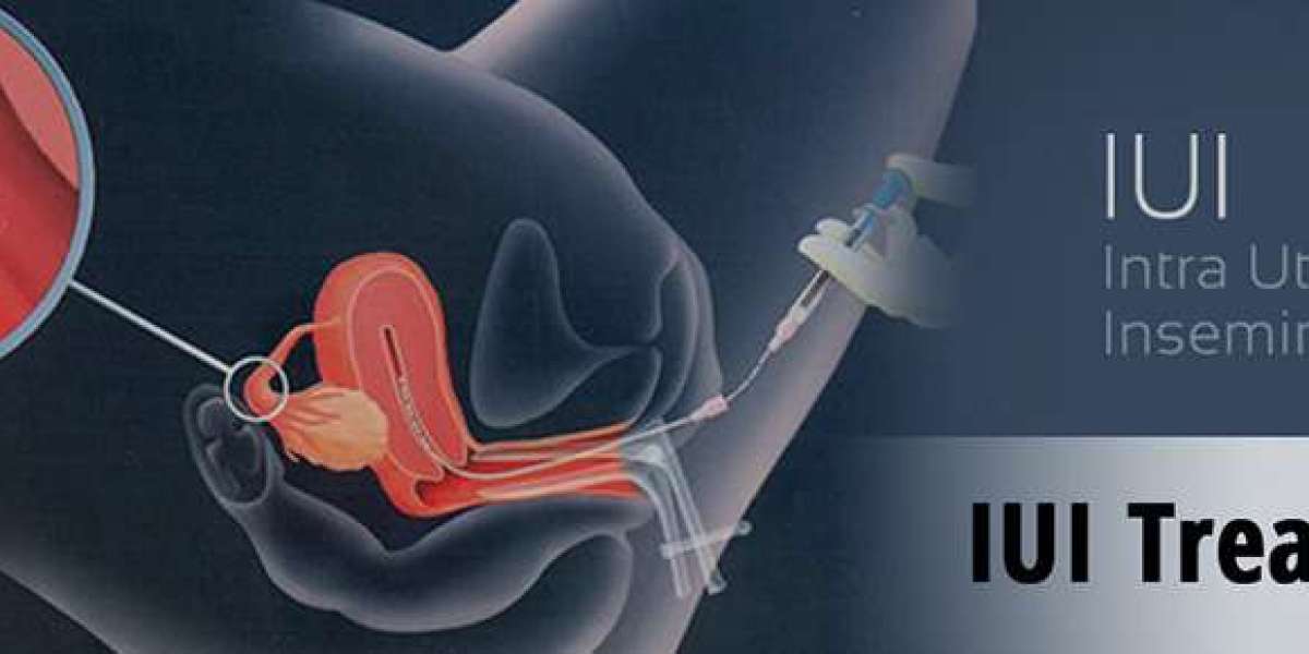 Empowering Future Choices: Fertility Preservation in Delhi