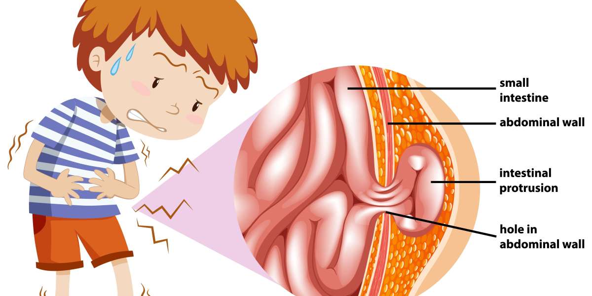 Best Hernia Surgeon in Bangalore – Safe & Advanced Treatment with Dr. Bhushan Chittawadagi