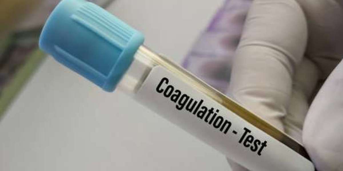 "Coagulation Testing Market Expands as Healthcare Providers Adopt New Diagnostic Innovations"