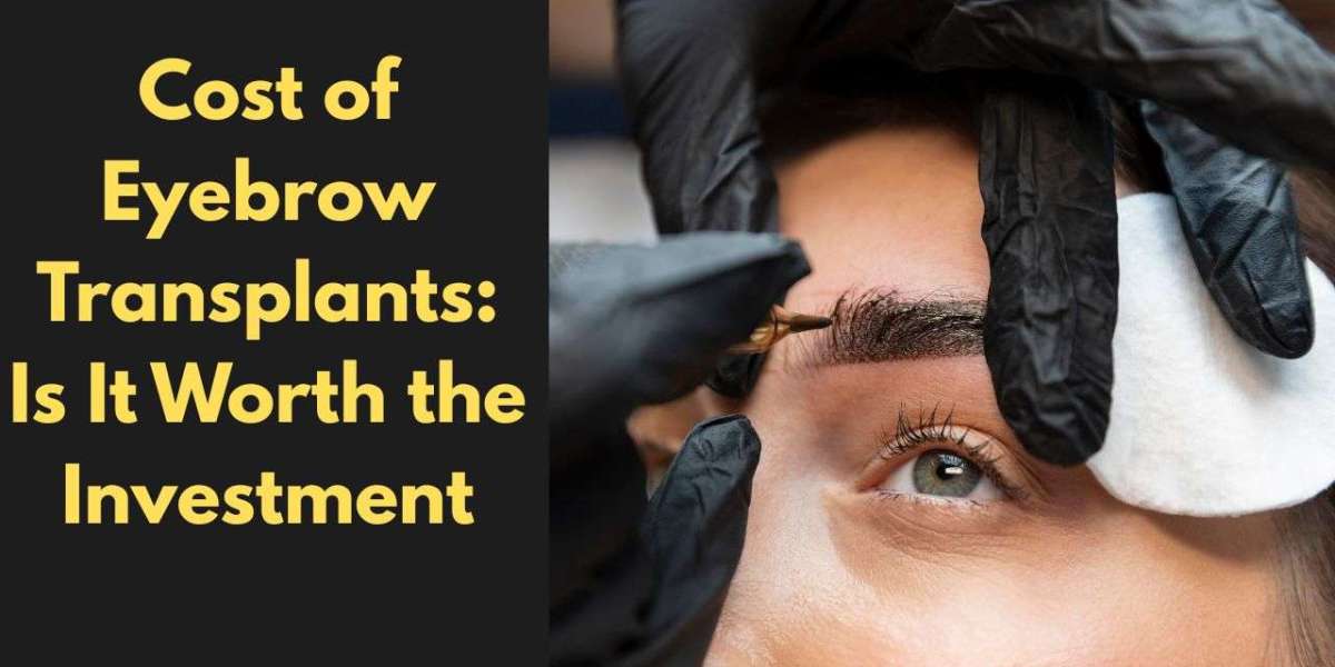Cost of Eyebrow Transplants: Is It Worth the Investment