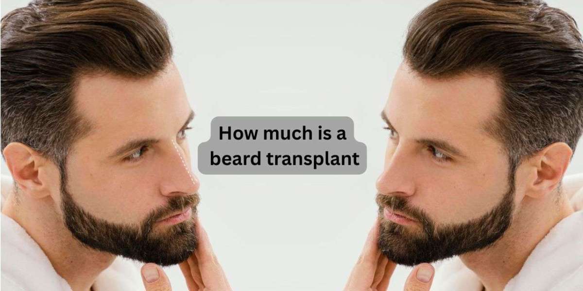 How Much Does a Beard Transplant Cost?
