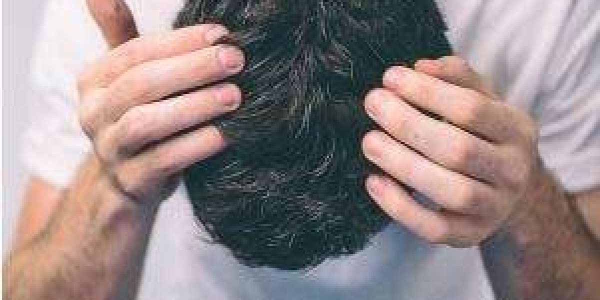What Hair System for Men Looks Most Natural?