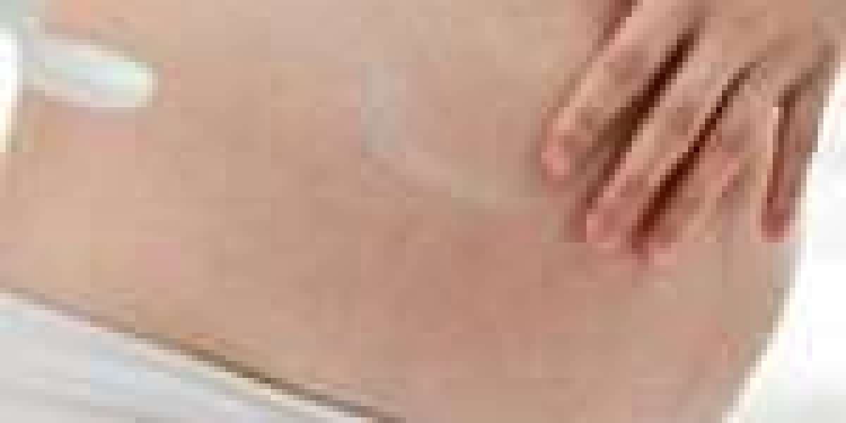 Transform Your Skin with Chemical Peel for Stretch Marks in Florida | Stellar Health and Skin