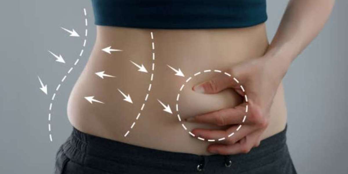 https://www.facebook.com/SlimMeDetoxTeaIreland/