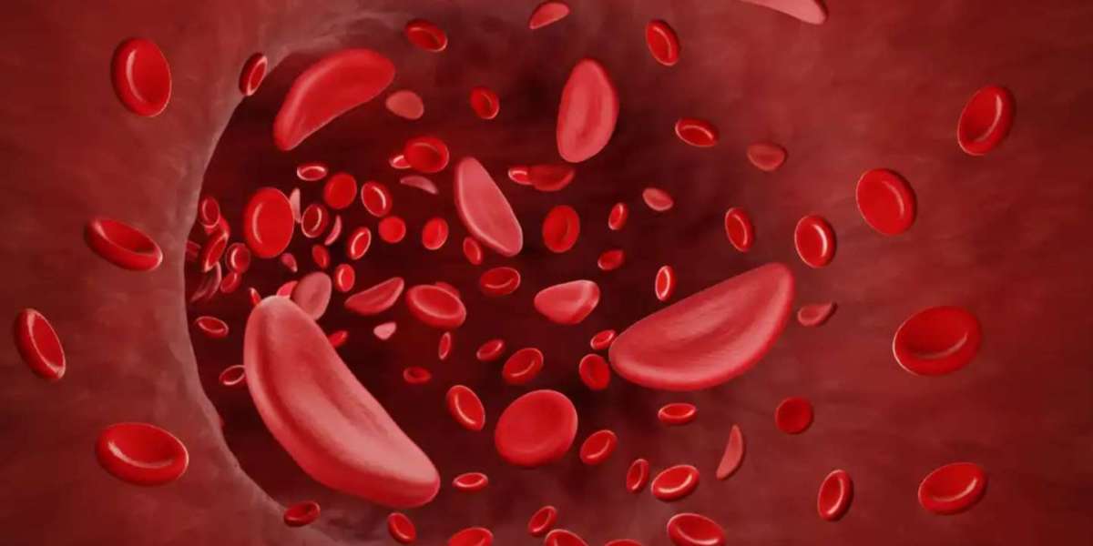 Sickle Cell Disease Treatment Market Revenue Analysis to 2033