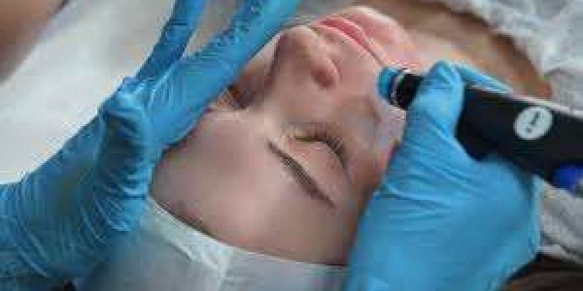 Painless laser hair removal queen street east Toronto
