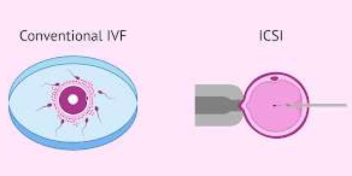 Best IVF Centre in Delhi & Pitampura | Affordable Price