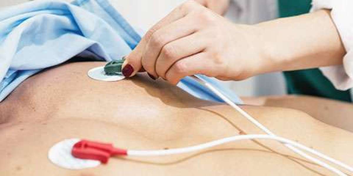 Understanding ECG: A Comprehensive Guide to Electrocardiograms