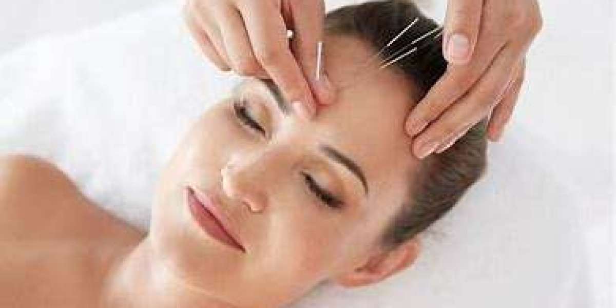 Can Acupuncture Help Autoimmune Disorders? Benefits & Science