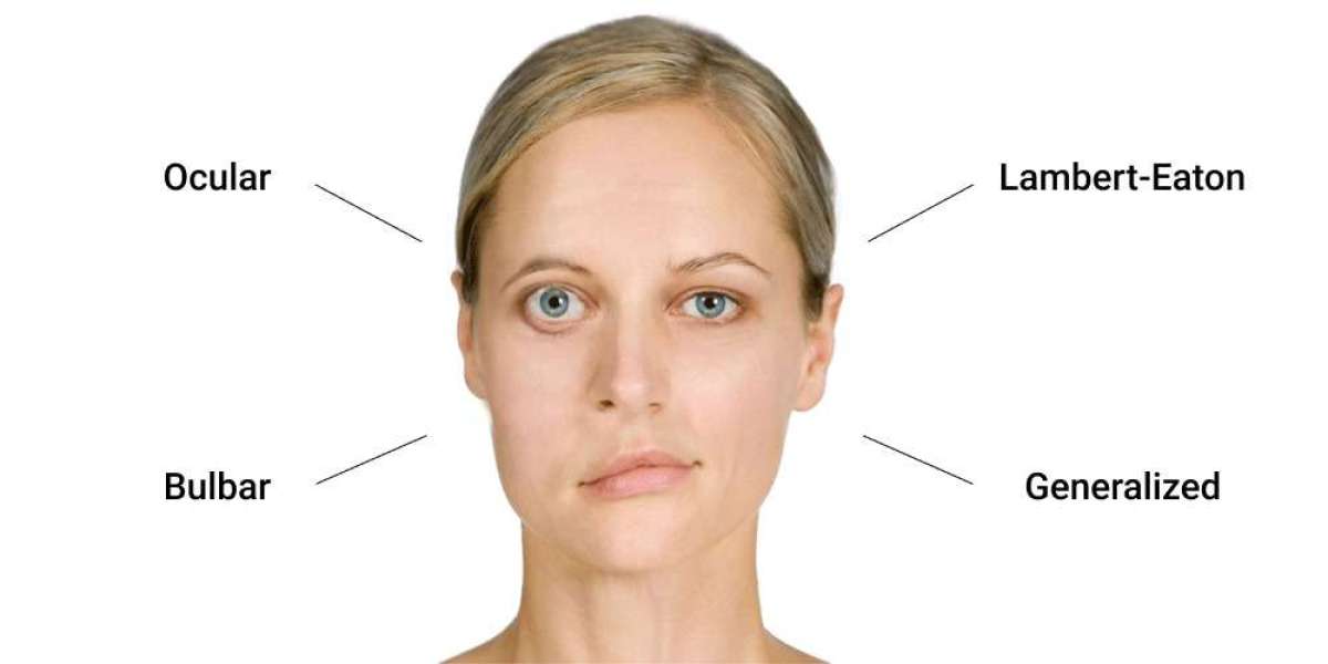 Top Home Remedies to Ease Myasthenia Gravis Naturally: Experts Reveal
