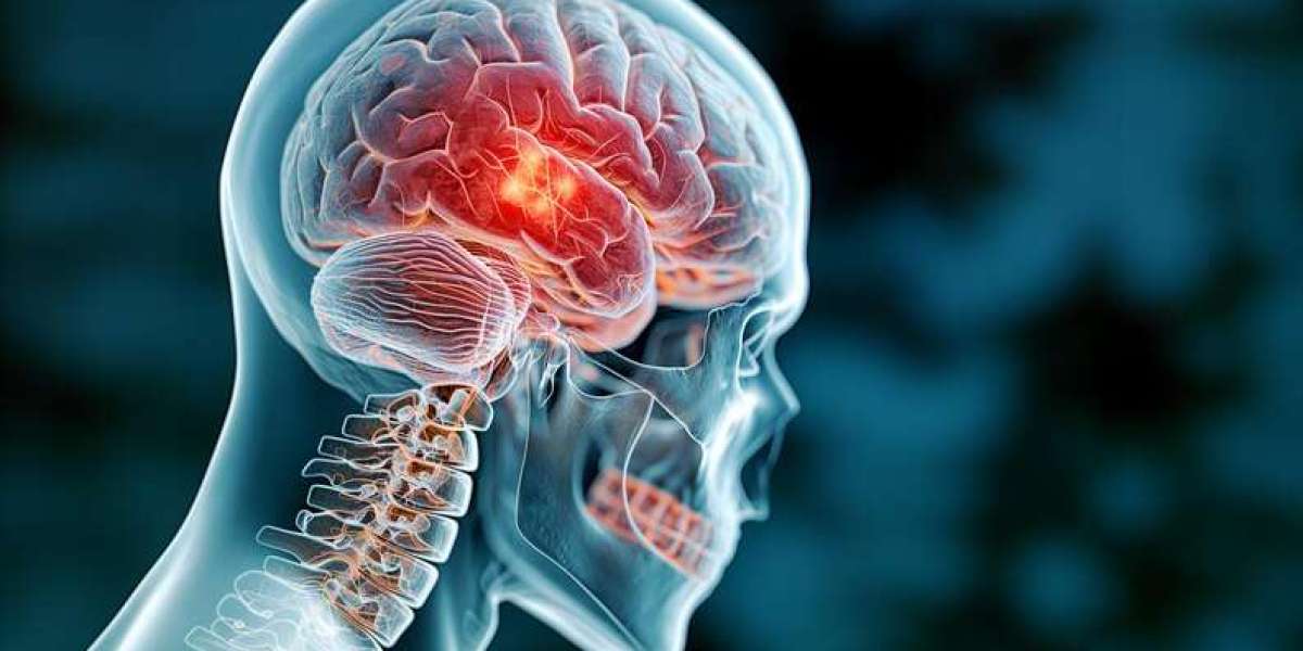 Siderosis Market Intelligence Platform: Comprehensive Therapeutic Assessment, Clinical Outcomes, and Industry Benchmarki