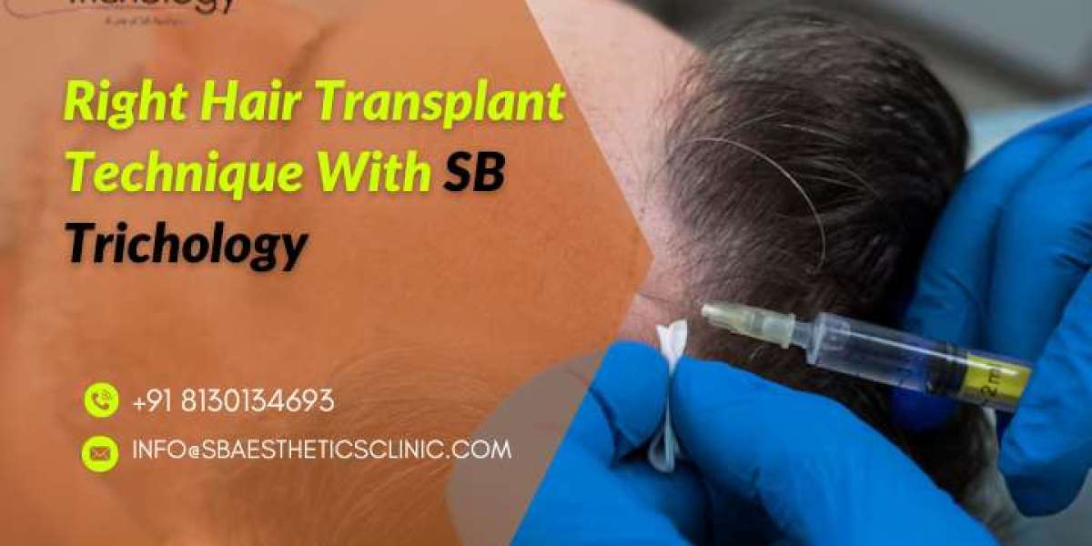 Choosing the right hair transplant technique: Which one is right for you?