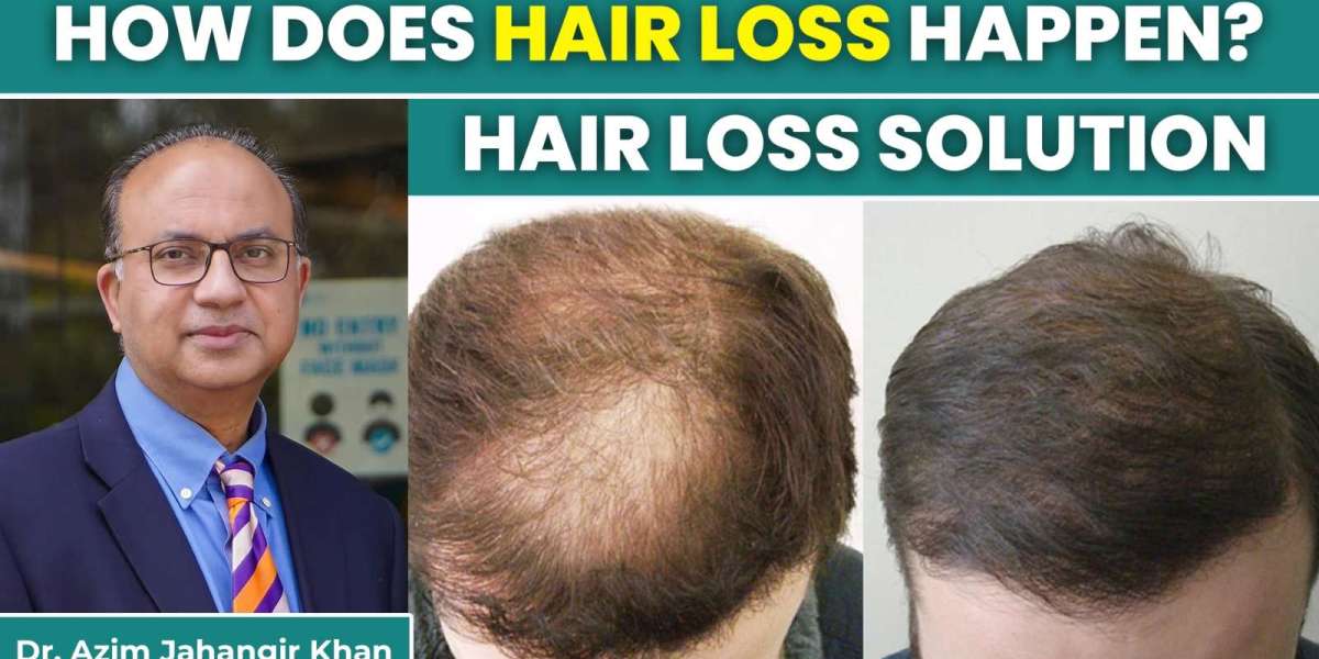 Don’t Ignore These Underlying Reasons for Hair Loss