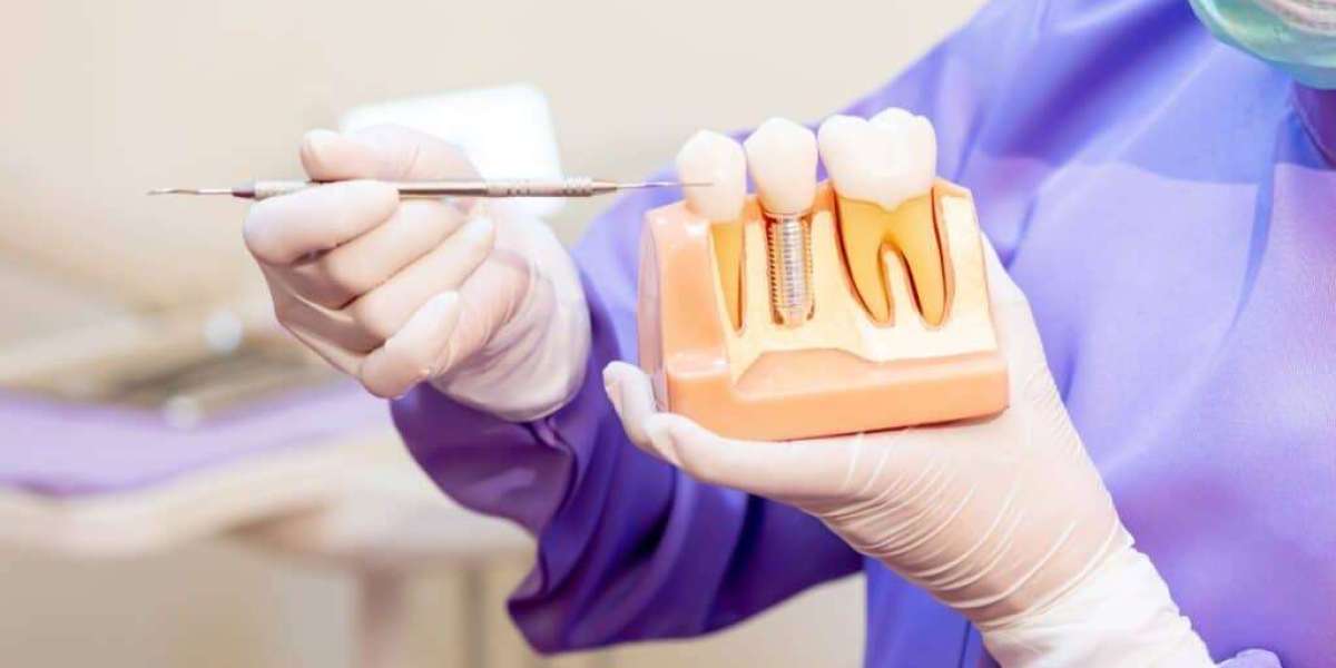 Eat, Talk & Smile Again with Dental Implants in Tampa