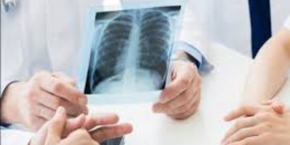 Finding the Best X Ray Lab Near Me: A Complete Guide to Accuracy, Convenience & Care