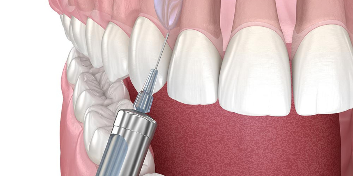 Dental Anesthetics Market Obstacles: Key Factors Limiting Expansion and Technological Integration Globally