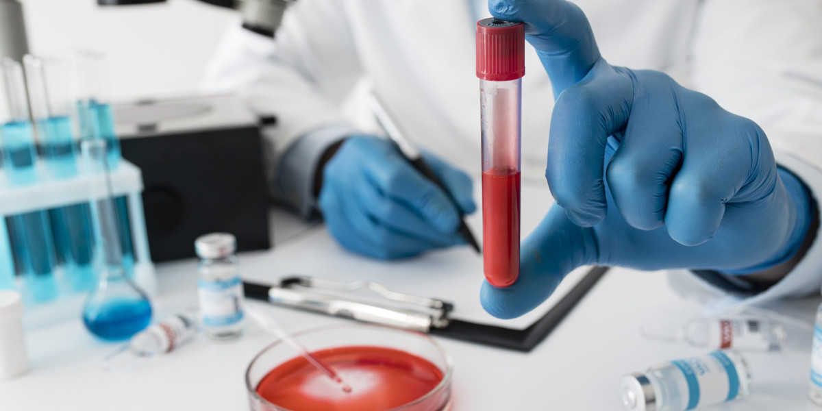 Convenient Health at Your Doorstep: Home Blood Test Bangalore
