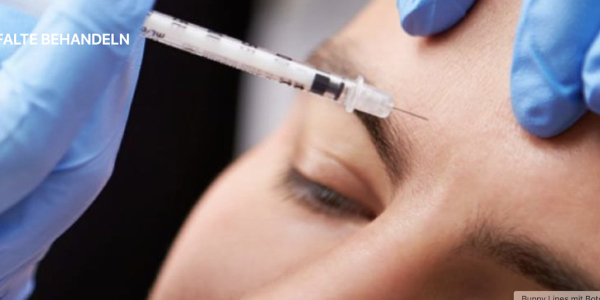 Die Zornesfalte verstehen