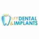 My Dental and Implants