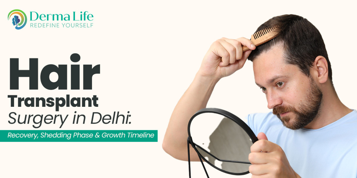 Hair Transplant in Delhi: Hair Transplant Full Guide to the Price, Clinic, and Hair Restoration.