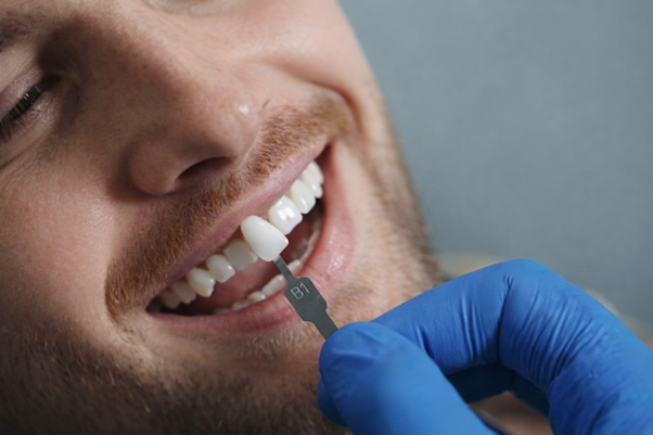 Top Things to Know Before Getting a Dental Crown