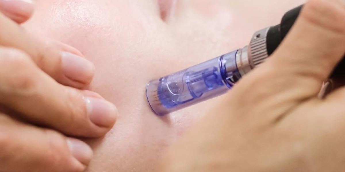Transform Your Skin with Microneedling Treatment in Manchester