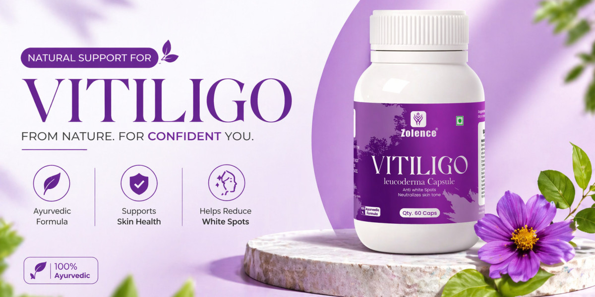 What Are the Benefits of Using Vitiligo Capsule for Long-Term Skin Support?