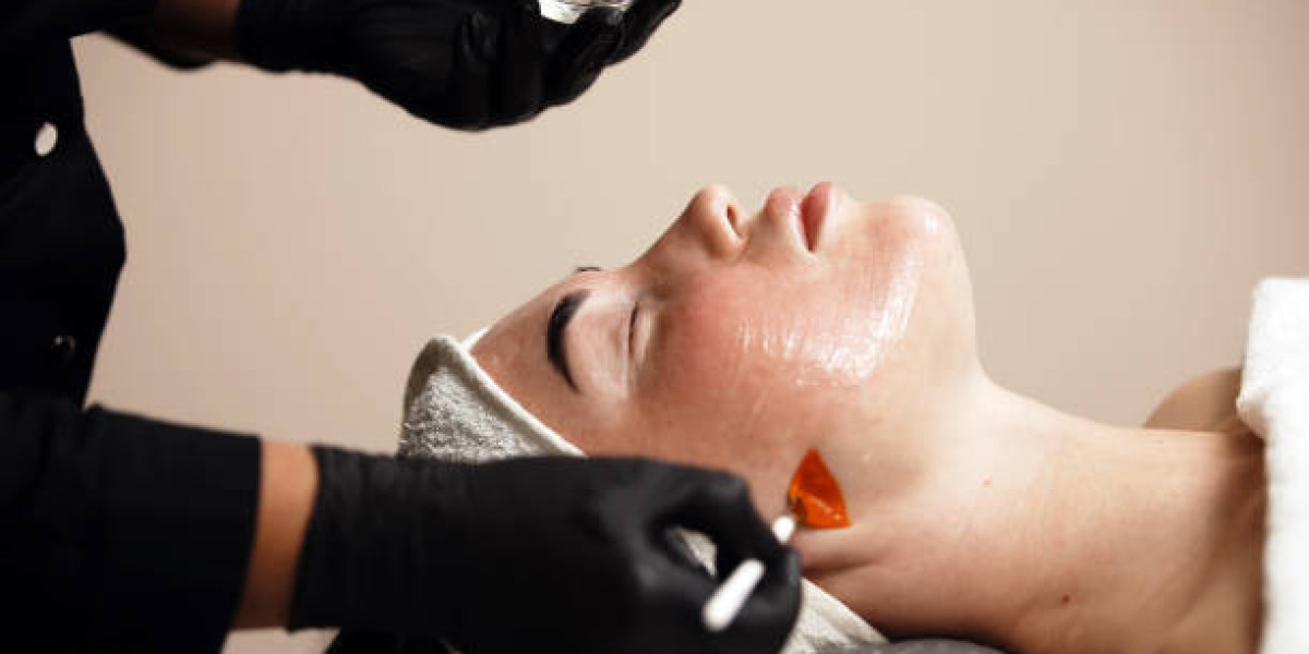 How to Choose the Right Chemical Peel for Your Skin Type