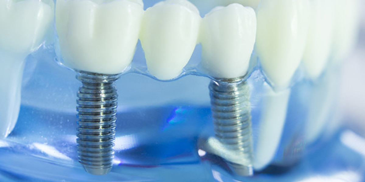 How Dental Implants and Dentures Restore Your Smile and Confidence