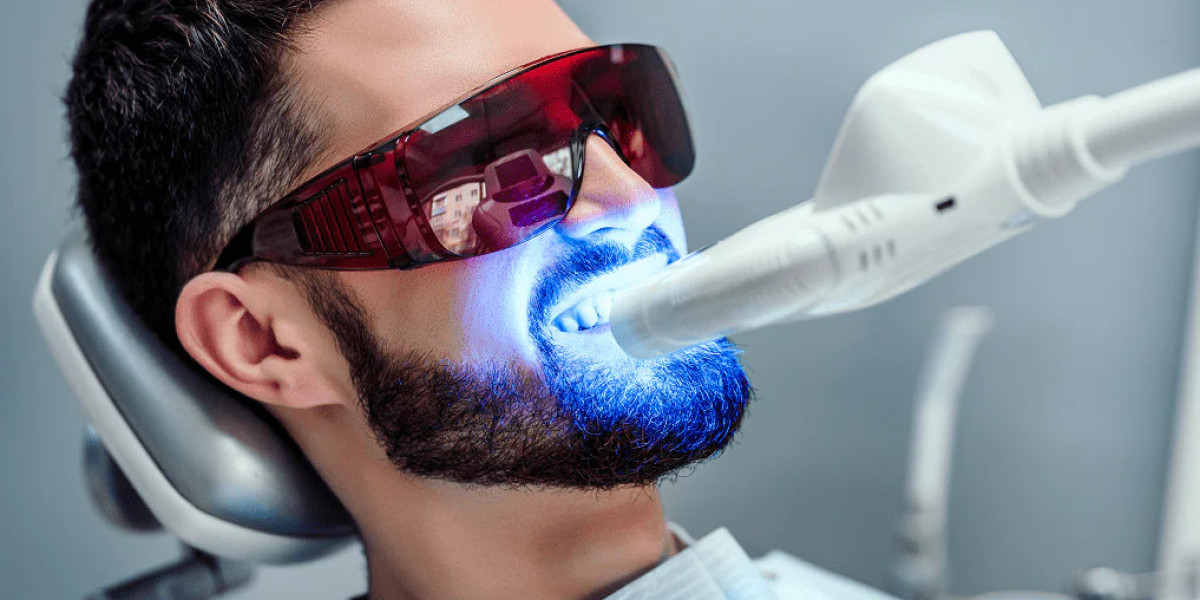 Top Benefits of Professional Teeth Whitening Treatments