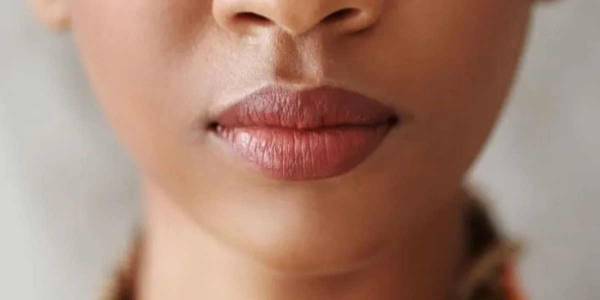 What Makes Smoker Lips Treatment in Islamabad So Effective?