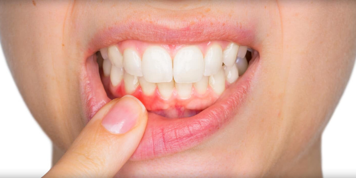 How to Prevent Periodontal Disease and Maintain Healthy Gums
