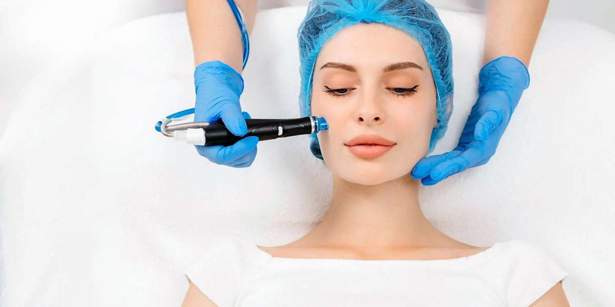 Hydrafacial in Islamabad for Acne-Prone Skin: What You Should Know