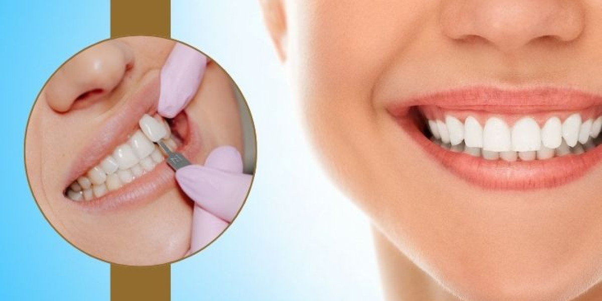 Top Benefits of Cosmetic Dentistry for Enhancing Your Smile