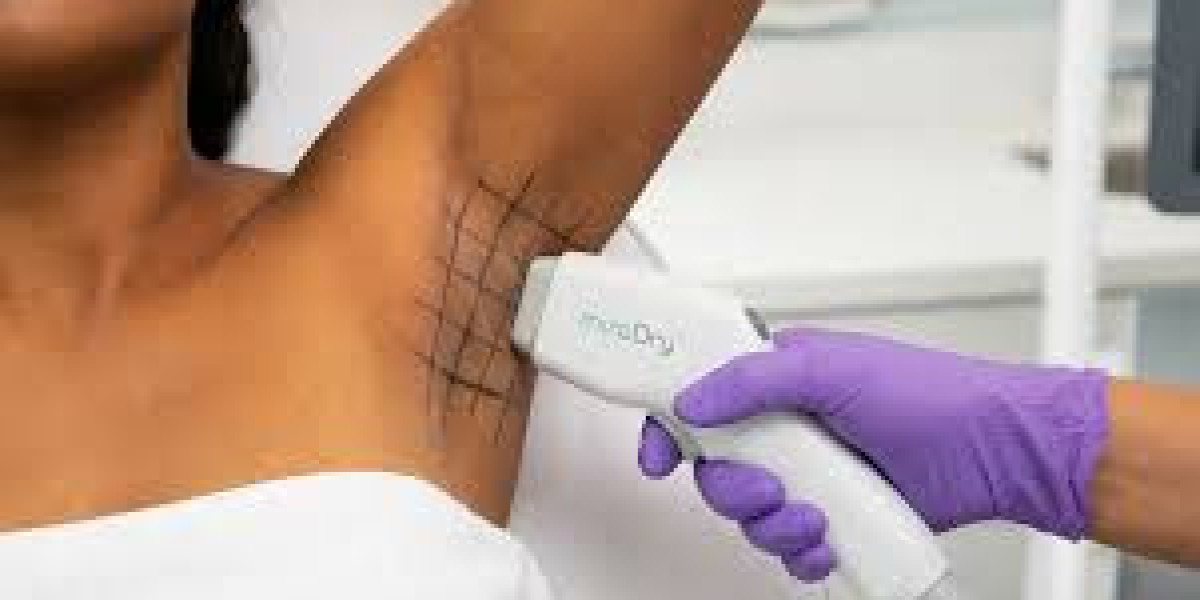Hyperhidrosis Treatment In Islamabad: Non-Surgical Options for Sweat Reduction