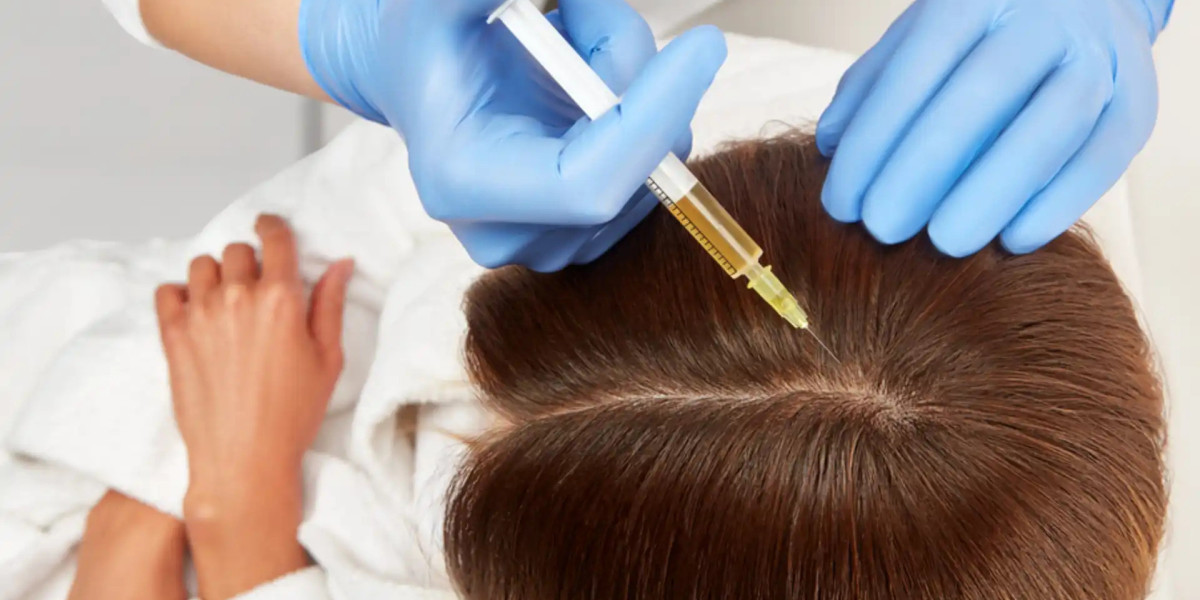 Maintaining Result After PRP Hair Treatment in Dubai or Hair Transplant in Dubai