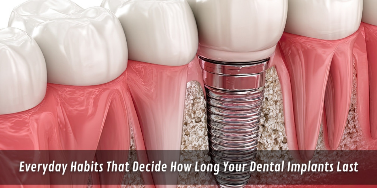 Everyday Habits That Decide How Long Your Dental Implants Last