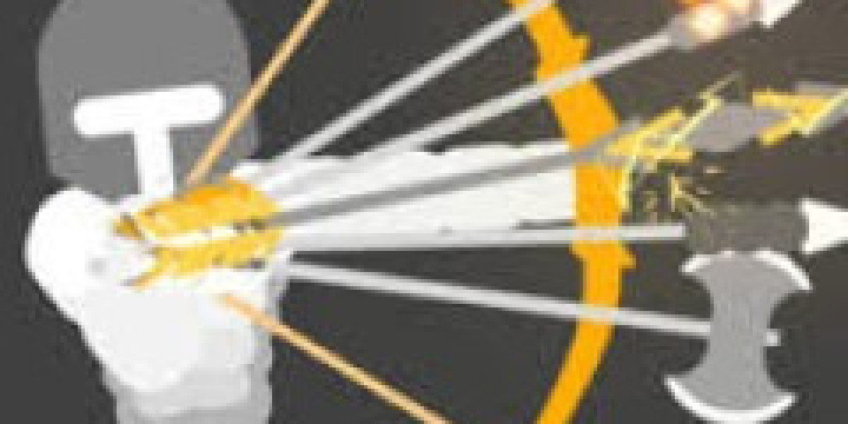 Things You Need to Know to Master Ragdoll Archers!